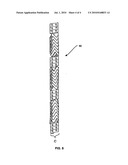 Stent With Reduced Profile, Delivery System, and Method of Manufacture diagram and image