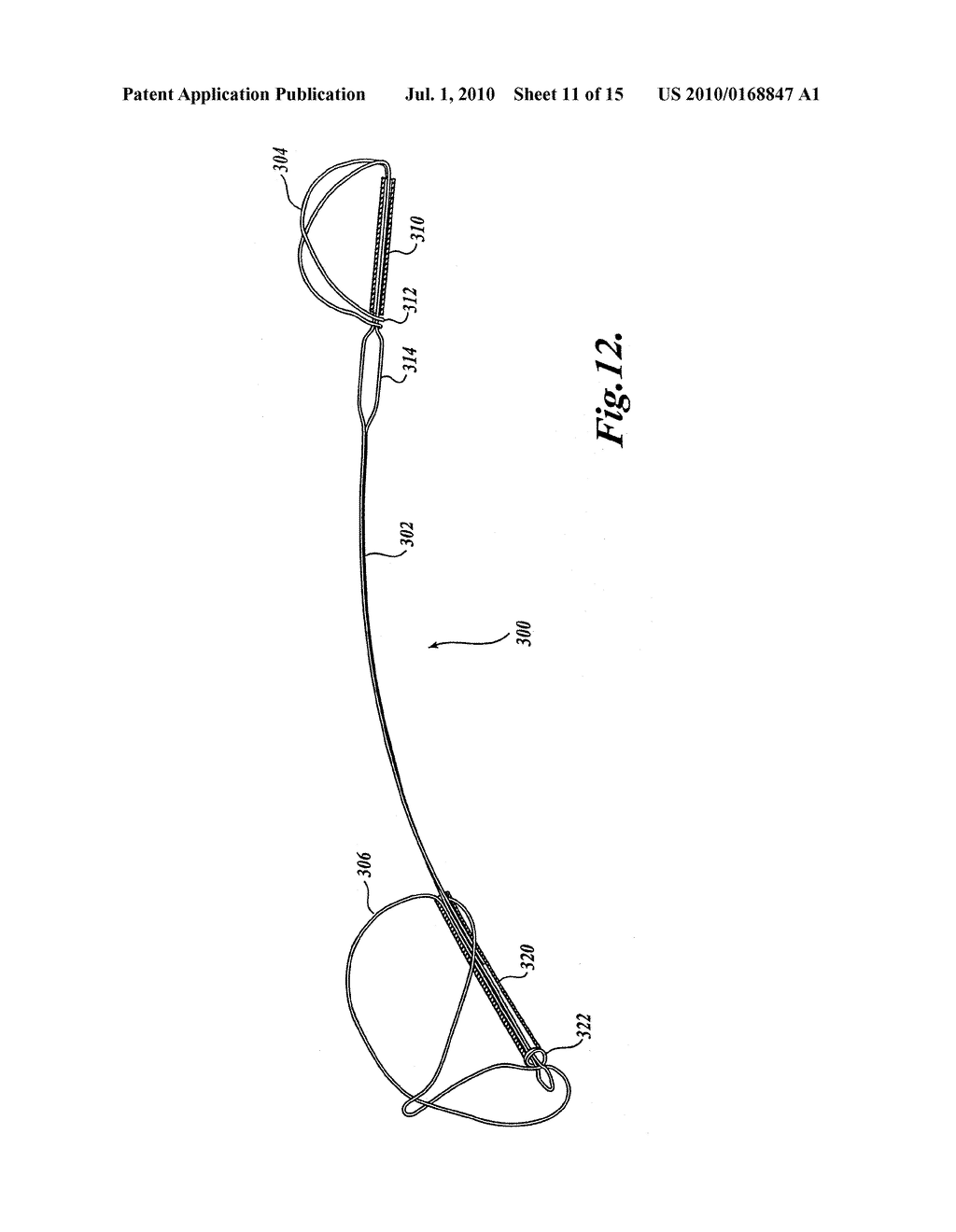 Device and Method for Modifying the Shape of a Body Organ - diagram, schematic, and image 12