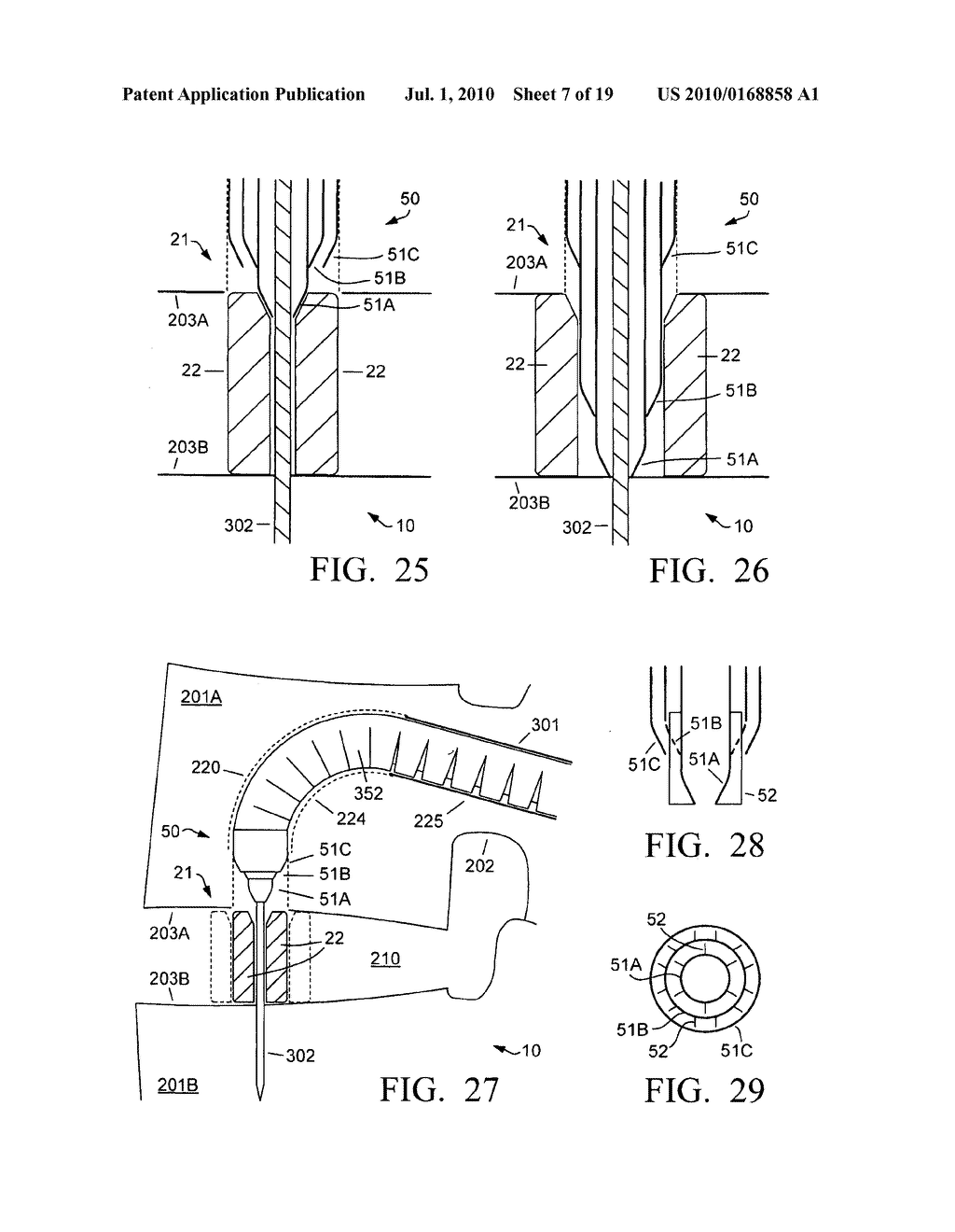 Expandable interbody implant and method - diagram, schematic, and image 08