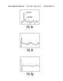 DEFINING QUANTITATIVE SIGNATURES FOR DIFFERENT GLEASON GRADES OF PROSTATE CANCER USING MAGNETIC RESONANCE SPECTROSCOPY diagram and image