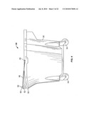 MOP BUCKET diagram and image