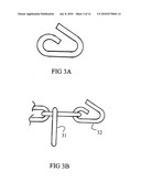 Easy mount tire chains diagram and image