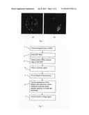 LOCALIZATION OF BRAIN LANDMARKS SUCH AS THE ANTERIOR AND POSTERIOR COMMISSURES BASED ON GEOMETRICAL FITTING diagram and image