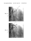 AUTOMATIC ENHANCEMENT OF AN IMAGE STREAM OF A MOVING ORGAN diagram and image