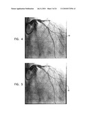 AUTOMATIC ENHANCEMENT OF AN IMAGE STREAM OF A MOVING ORGAN diagram and image