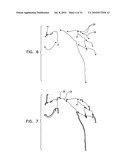 AUTOMATIC ENHANCEMENT OF AN IMAGE STREAM OF A MOVING ORGAN diagram and image