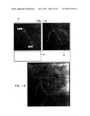 AUTOMATIC ENHANCEMENT OF AN IMAGE STREAM OF A MOVING ORGAN diagram and image