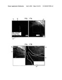 AUTOMATIC ENHANCEMENT OF AN IMAGE STREAM OF A MOVING ORGAN diagram and image