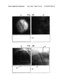 AUTOMATIC ENHANCEMENT OF AN IMAGE STREAM OF A MOVING ORGAN diagram and image