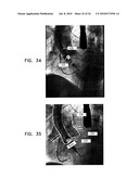 AUTOMATIC ENHANCEMENT OF AN IMAGE STREAM OF A MOVING ORGAN diagram and image