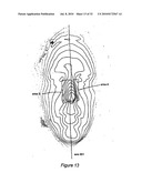 SYSTEM AND METHOD FOR USING THREE DIMENSIONAL INFRARED IMAGING TO PROVIDE DETAILED ANATOMICAL STRUCTURE MAPS diagram and image