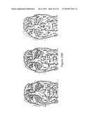 SYSTEM AND METHOD FOR USING THREE DIMENSIONAL INFRARED IMAGING TO PROVIDE DETAILED ANATOMICAL STRUCTURE MAPS diagram and image