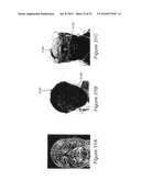 SYSTEM AND METHOD FOR USING THREE DIMENSIONAL INFRARED IMAGING TO PROVIDE DETAILED ANATOMICAL STRUCTURE MAPS diagram and image