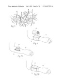 Wound dressing devices and methods diagram and image