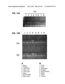 NOVEL SERPENTINE TRANSMEMBRANE ANTIGENS EXPRESSED IN HUMAN CANCERS AND USES THEREOF diagram and image