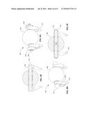 CONTINUOUSLY VARIABLE TRANSMISSION diagram and image