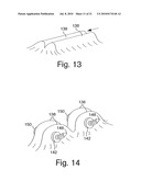 INTEGRATED ENDOSCOPE AND ACCESSORY TREATMENT DEVICE diagram and image