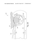 INTEGRATED ENDOSCOPE AND ACCESSORY TREATMENT DEVICE diagram and image