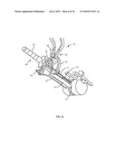 SURGICAL ACCESS SYSTEM AND RELATED METHODS diagram and image