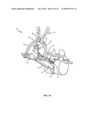 SURGICAL ACCESS SYSTEM AND RELATED METHODS diagram and image