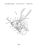 SURGICAL ACCESS SYSTEM AND RELATED METHODS diagram and image