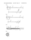 Balloon Catheter diagram and image