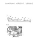 Balloon Catheter diagram and image