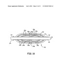 ANCHOR HAVING FILL PORT FOR USE WITH AN IMPLANTABLE THERAPY DELIVERY ELEMENT diagram and image