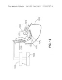 DEVICES, SYSTEMS, AND METHODS FOR REMOVING CONTRAST FROM LUMINAL ORGANS diagram and image