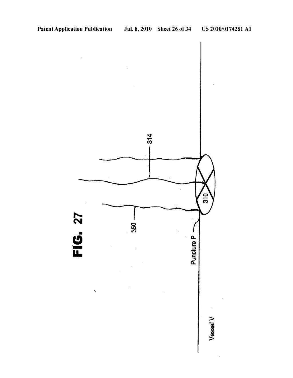 VESSEL SEALING DEVICES - diagram, schematic, and image 27