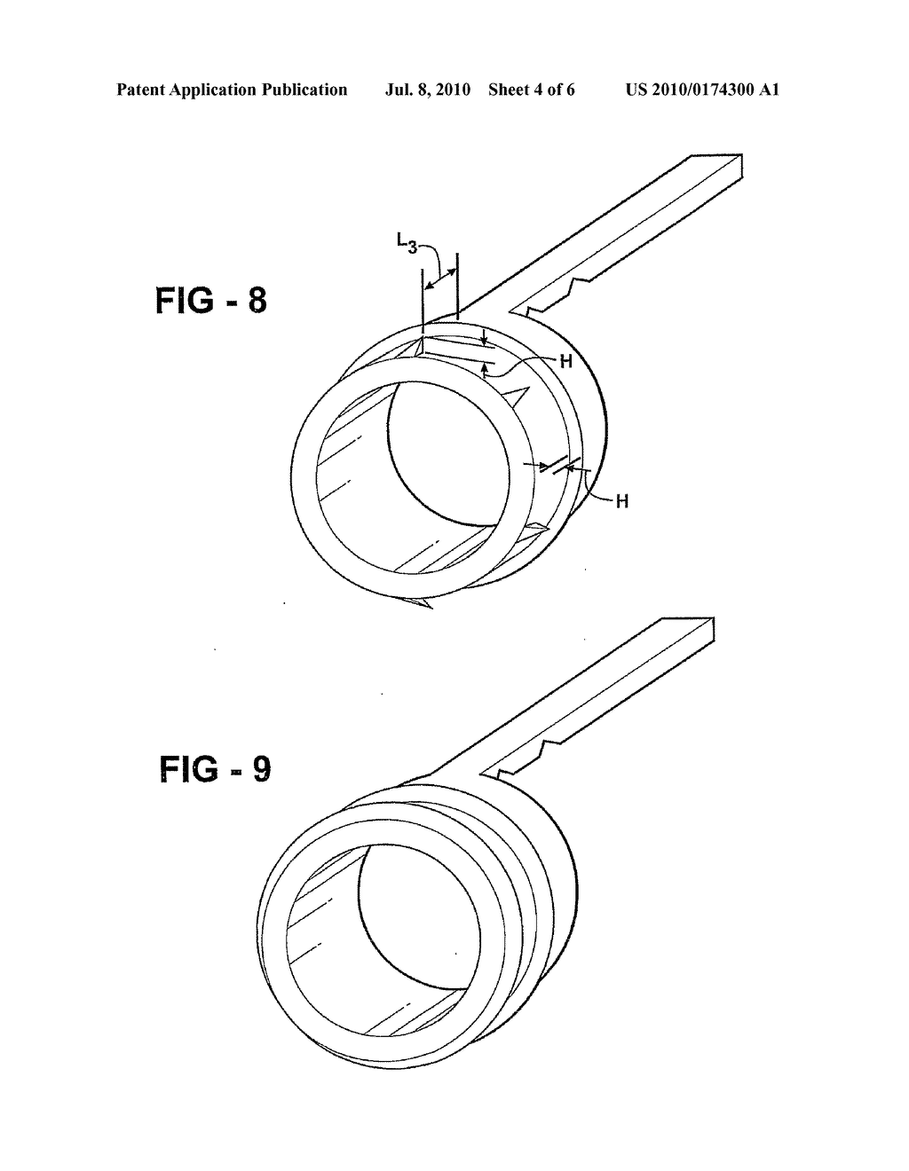 SUTURELESS VESSEL ANASTOMOSIS METHOD AND APPARATUS - diagram, schematic, and image 05