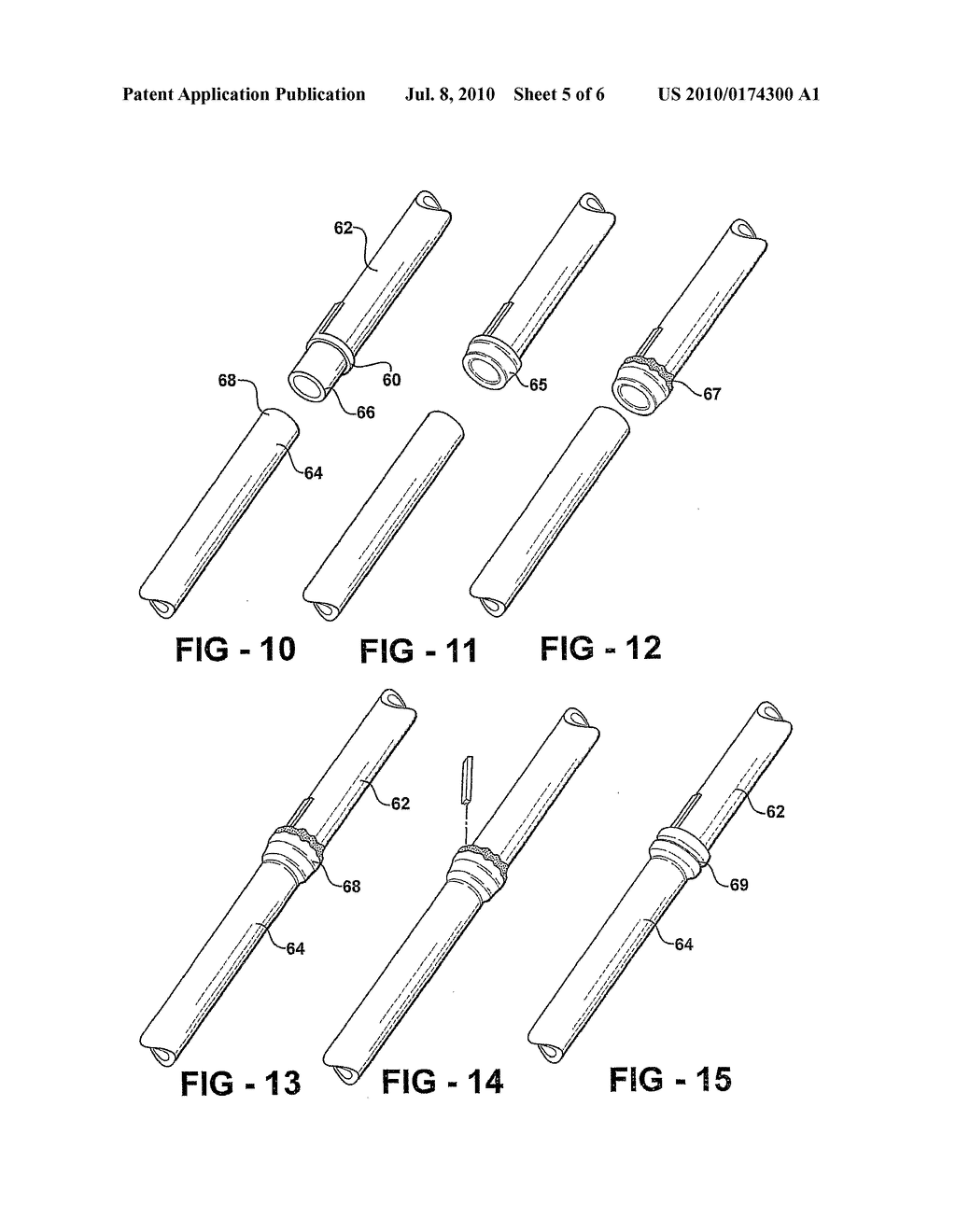 SUTURELESS VESSEL ANASTOMOSIS METHOD AND APPARATUS - diagram, schematic, and image 06