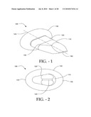 DISTRACTIBLE INTERSPINOUS PROCESS IMPLANT AND METHOD OF IMPLANTATION diagram and image