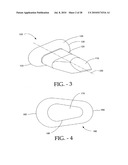 DISTRACTIBLE INTERSPINOUS PROCESS IMPLANT AND METHOD OF IMPLANTATION diagram and image