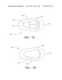 DISTRACTIBLE INTERSPINOUS PROCESS IMPLANT AND METHOD OF IMPLANTATION diagram and image