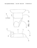 DISTRACTIBLE INTERSPINOUS PROCESS IMPLANT AND METHOD OF IMPLANTATION diagram and image