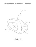 DISTRACTIBLE INTERSPINOUS PROCESS IMPLANT AND METHOD OF IMPLANTATION diagram and image