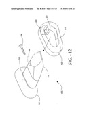 DISTRACTIBLE INTERSPINOUS PROCESS IMPLANT AND METHOD OF IMPLANTATION diagram and image