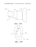 DISTRACTIBLE INTERSPINOUS PROCESS IMPLANT AND METHOD OF IMPLANTATION diagram and image