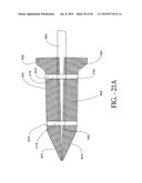 DISTRACTIBLE INTERSPINOUS PROCESS IMPLANT AND METHOD OF IMPLANTATION diagram and image