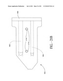 DISTRACTIBLE INTERSPINOUS PROCESS IMPLANT AND METHOD OF IMPLANTATION diagram and image