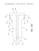 DISTRACTIBLE INTERSPINOUS PROCESS IMPLANT AND METHOD OF IMPLANTATION diagram and image