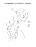 DISTRACTIBLE INTERSPINOUS PROCESS IMPLANT AND METHOD OF IMPLANTATION diagram and image