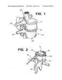 Method and compostion for repair and reconstruction of intervertebral discs and other reconstructive surgery diagram and image