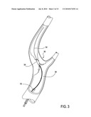 Catheter system for angioplasty and stenting with embolic protection diagram and image