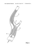 Catheter system for angioplasty and stenting with embolic protection diagram and image