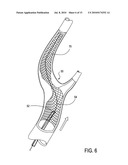 Catheter system for angioplasty and stenting with embolic protection diagram and image