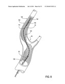 Catheter system for angioplasty and stenting with embolic protection diagram and image