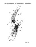 Catheter system for angioplasty and stenting with embolic protection diagram and image