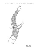 Catheter system for angioplasty and stenting with embolic protection diagram and image